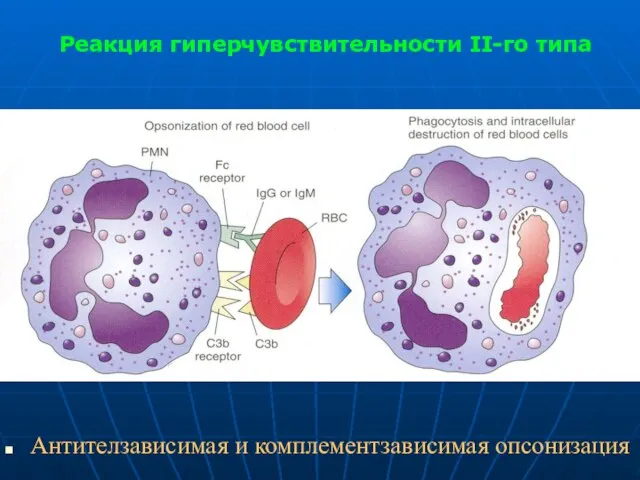 Реакция гиперчувствительности II-го типа Антителзависимая и комплементзависимая опсонизация