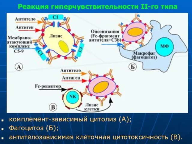 Реакция гиперчувствительности II-го типа комплемент-зависимый цитолиз (А); Фагоцитоз (Б); антителозависимая клеточная цитотоксичность (В).