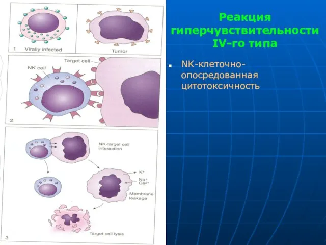 Реакция гиперчувствительности IV-го типа NK-клеточно-опосредованная цитотоксичность