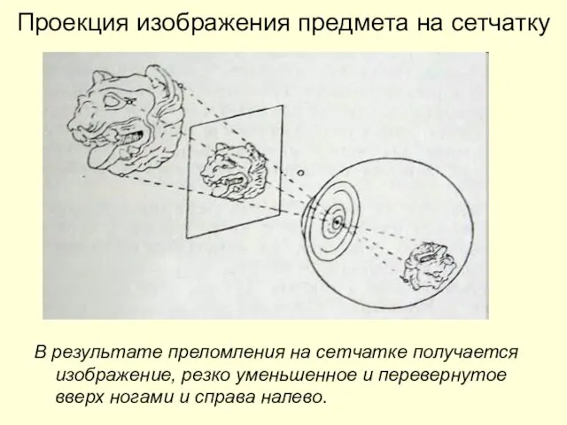 Проекция изображения предмета на сетчатку В результате преломления на сетчатке получается