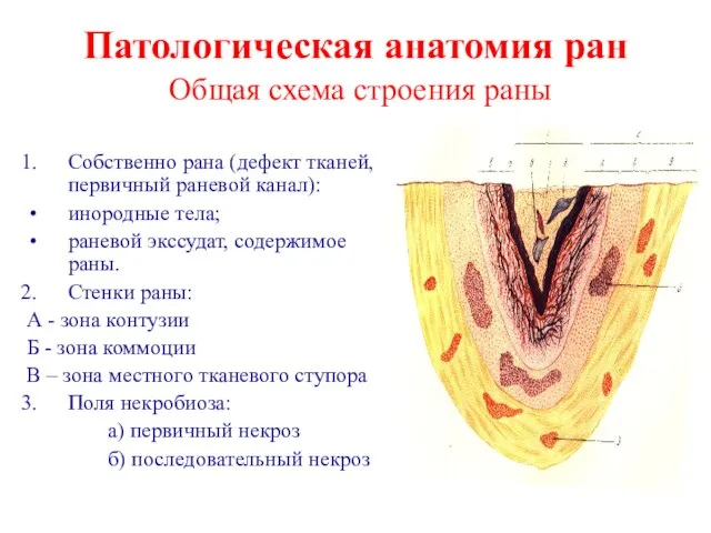 Патологическая анатомия ран Общая схема строения раны Собственно рана (дефект тканей,