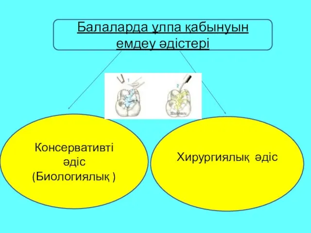 Балаларда ұлпа қабынуын емдеу әдістері Консервативті әдіс (Биологиялық ) Хирургиялық әдіс