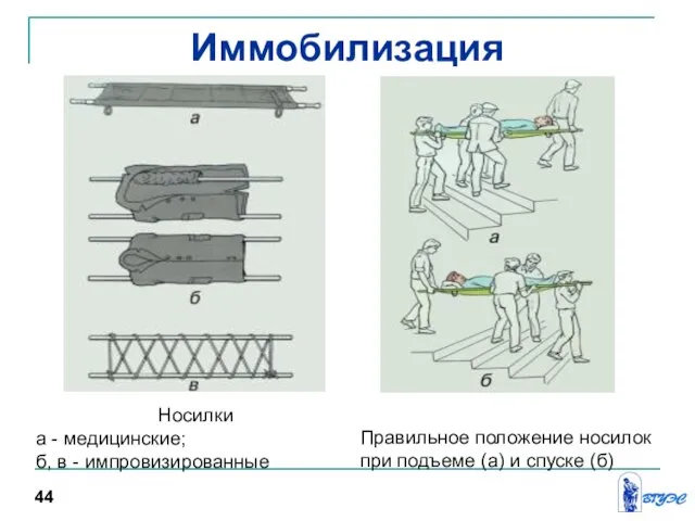 Иммобилизация Носилки а - медицинские; б, в - импровизированные Правильное положение