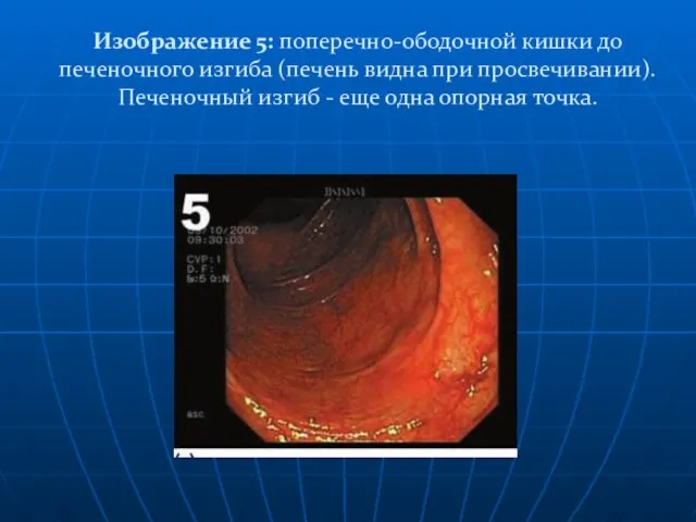 Изображение 5: поперечно-ободочной кишки до печеночного изгиба (печень видна при просвечивании).