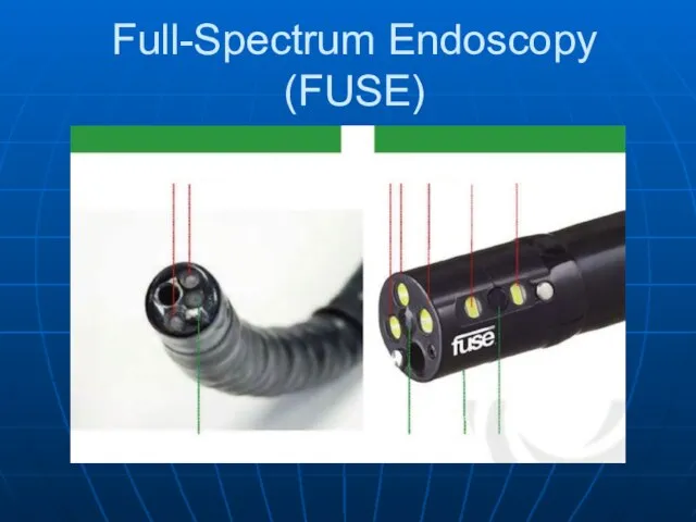 Full-Spectrum Endoscopy (FUSE)