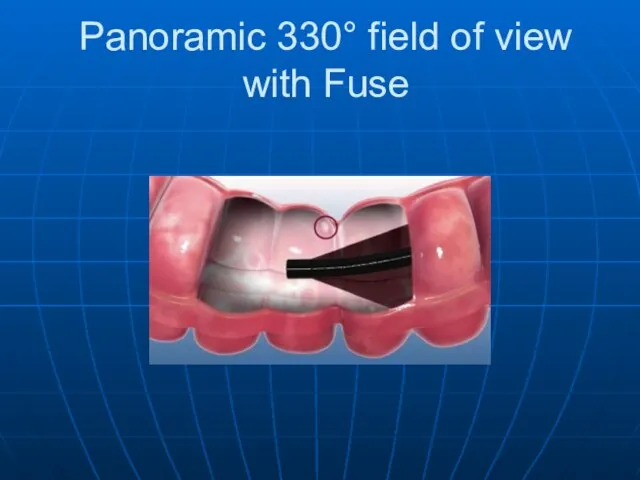 Panoramic 330° field of view with Fuse