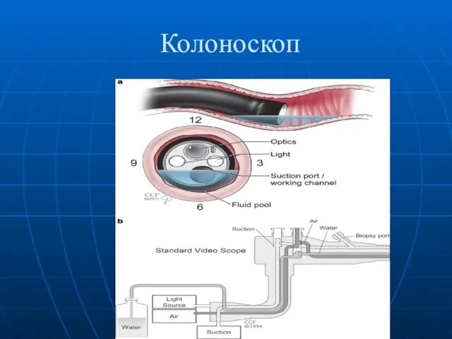 Колоноскоп