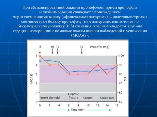 При сбалансированной седации пропофолом, прием пропофола и глубина седации совпадает с