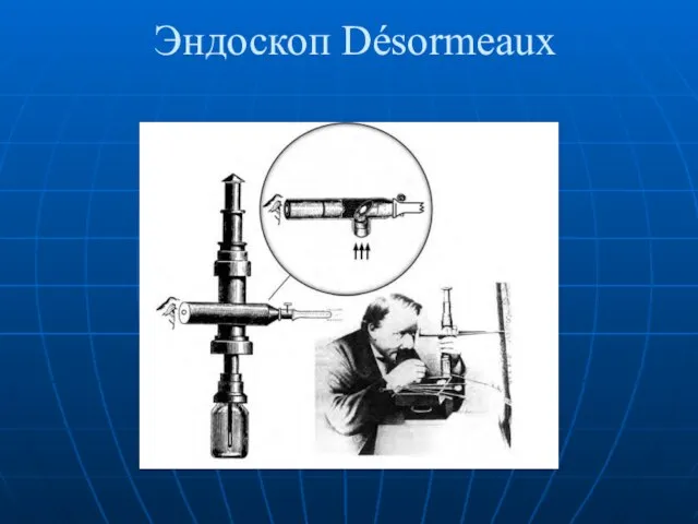 Эндоскоп Désormeaux