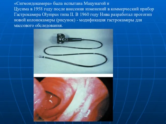 «Сигмоидокамера» была испытана Мацунагой и Цусима в 1958 году после внесения