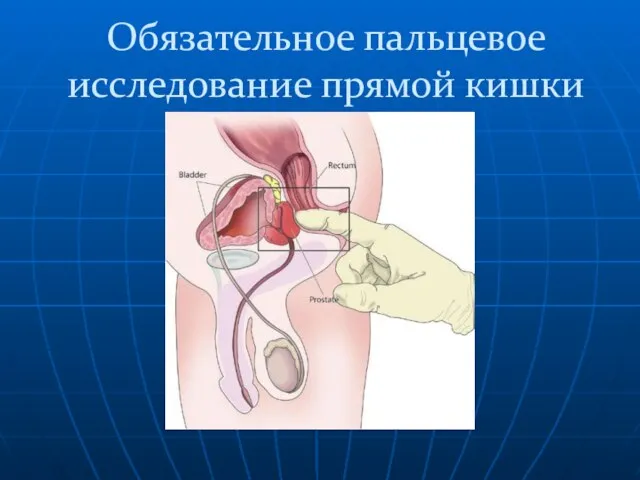 Обязательное пальцевое исследование прямой кишки