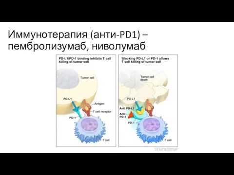 Иммунотерапия (анти-PD1) – пембролизумаб, ниволумаб