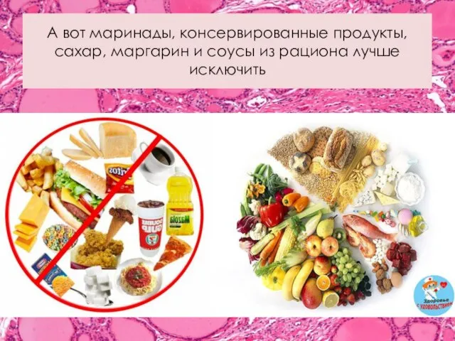 А вот маринады, консервированные продукты, сахар, маргарин и соусы из рациона лучше исключить