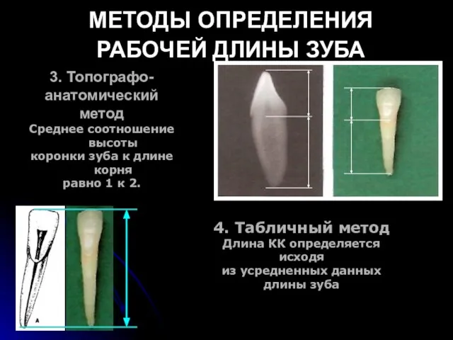 МЕТОДЫ ОПРЕДЕЛЕНИЯ РАБОЧЕЙ ДЛИНЫ ЗУБА 3. Топографо- анатомический метод Среднее соотношение