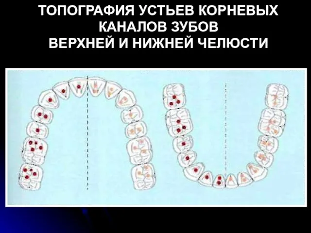 ТОПОГРАФИЯ УСТЬЕВ КОРНЕВЫХ КАНАЛОВ ЗУБОВ ВЕРХНЕЙ И НИЖНЕЙ ЧЕЛЮСТИ