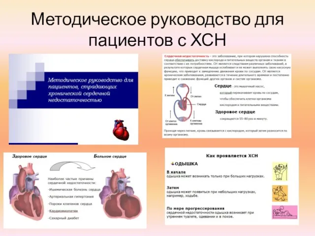 Методическое руководство для пациентов с ХСН