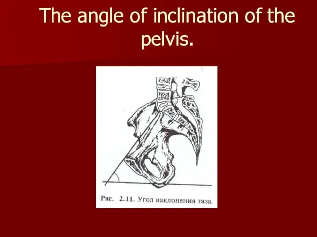 The angle of inclination of the pelvis.