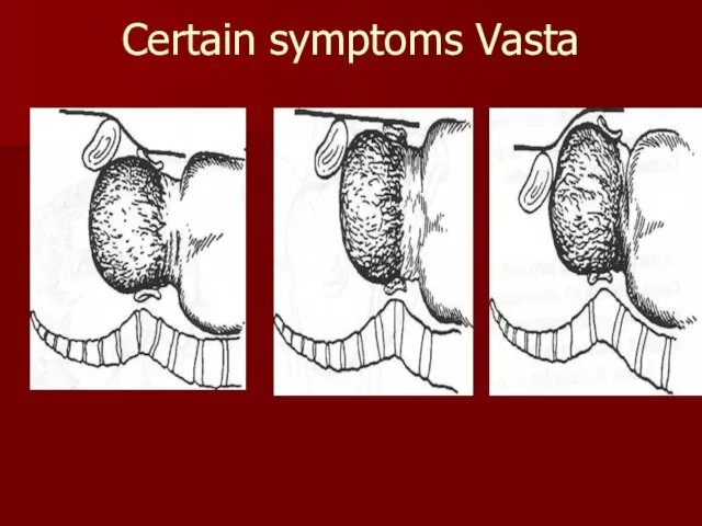 Certain symptoms Vasta