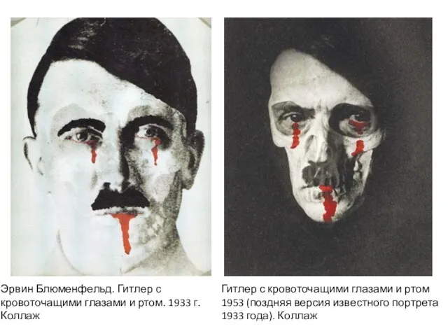 Эрвин Блюменфельд. Гитлер с кровоточащими глазами и ртом. 1933 г. Коллаж