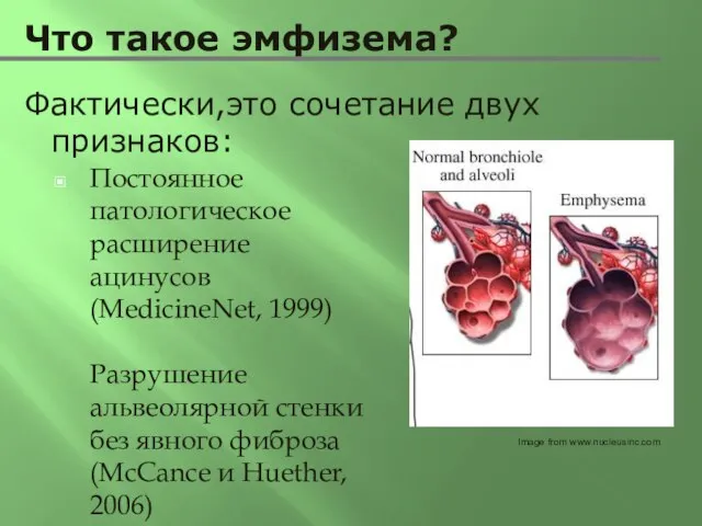 Что такое эмфизема? Постоянное патологическое расширение ацинусов (MedicineNet, 1999) Разрушение альвеолярной