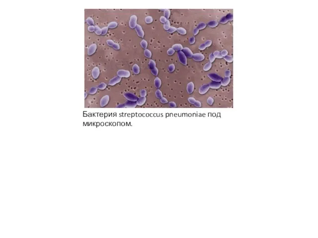 Бактерия streptococcus pneumoniae под микроскопом.