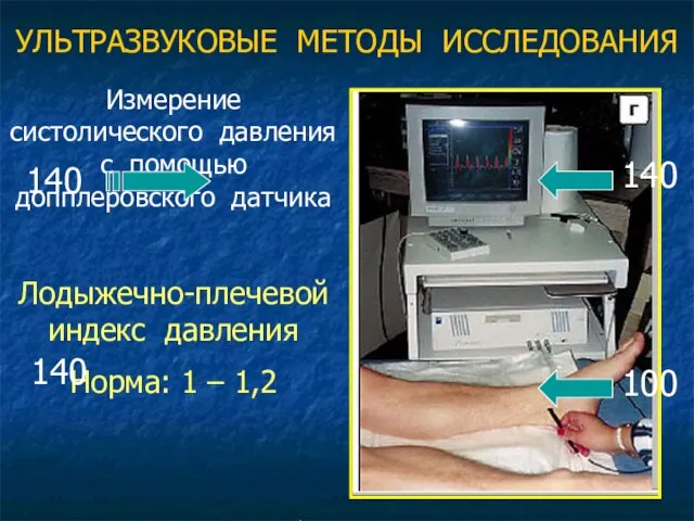 УЛЬТРАЗВУКОВЫЕ МЕТОДЫ ИССЛЕДОВАНИЯ Измерение систолического давления с помощью допплеровского датчика Лодыжечно-плечевой