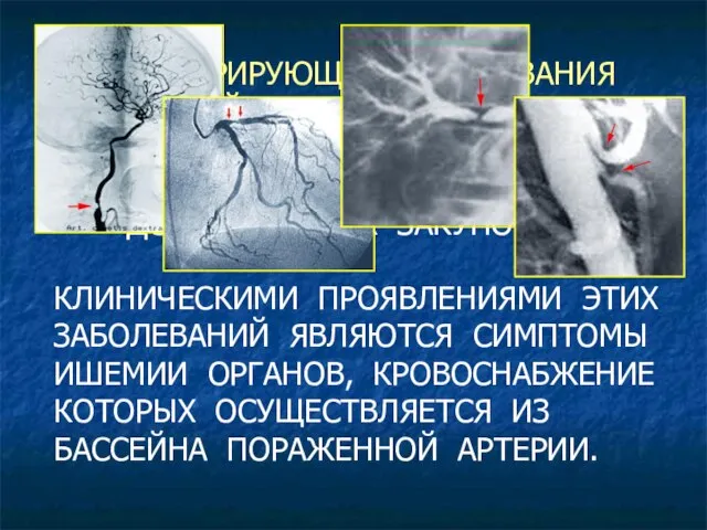 ОБЛИТЕРИРУЮЩИЕ ЗАБОЛЕВАНИЯ АРТЕРИЙ - ЭТО ЗАБОЛЕВАНИЯ, СОПРОВОЖДАЮЩИЕСЯ ПОСТЕПЕННЫМ СУЖЕНИЕМ ПРОСВЕТА АРТЕРИЙ