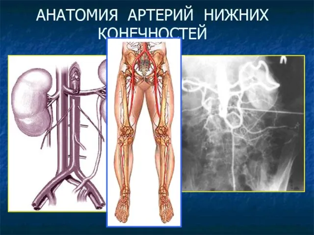 АНАТОМИЯ АРТЕРИЙ НИЖНИХ КОНЕЧНОСТЕЙ