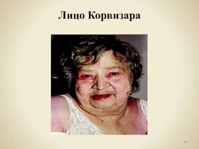 * Лицо Корвизара