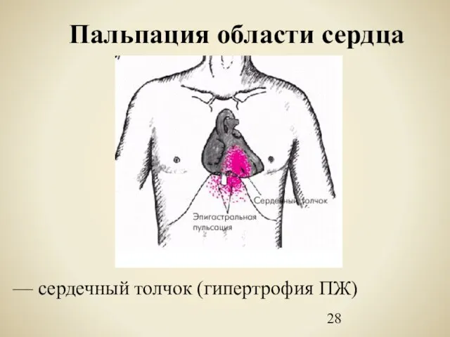 Пальпация области сердца — сердечный толчок (гипертрофия ПЖ)