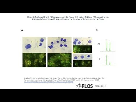 Figure 6. Analysis of X and Y Chromosomes of the Tumor