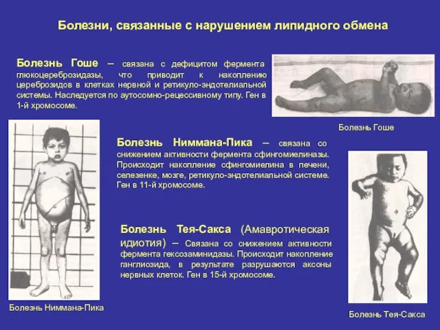 Болезни, связанные с нарушением липидного обмена Болезнь Гоше – связана с