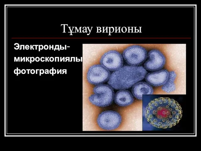 Тұмау вирионы Электронды- микроскопиялық фотография