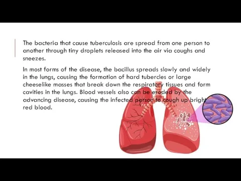 The bacteria that cause tuberculosis are spread from one person to