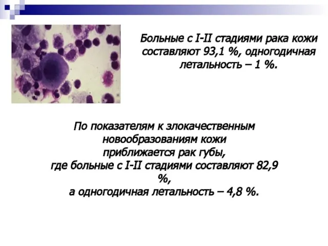 Больные с I-II стадиями рака кожи составляют 93,1 %, одногодичная летальность