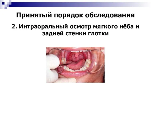 Принятый порядок обследования 2. Интраоральный осмотр мягкого нёба и задней стенки глотки