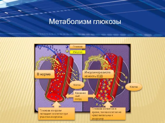 Метаболизм глюкозы В норме Инсулинорезистентность (СД) Глюкоза из крови попадает в