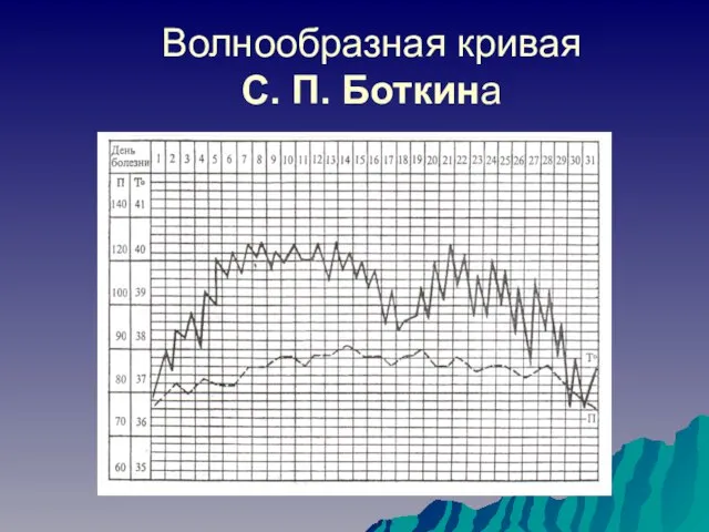 Волнообразная кривая С. П. Боткина