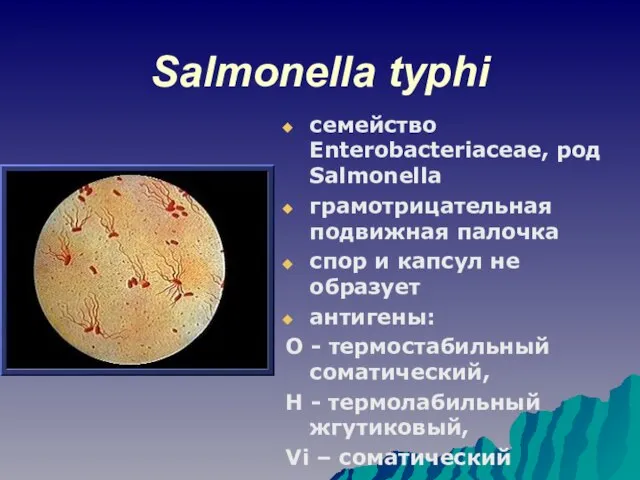 Salmonella typhi семейство Enterobacteriaceae, род Salmonella грамотрицательная подвижная палочка спор и