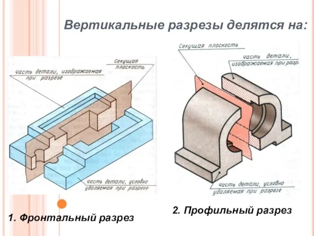 Вертикальные разрезы делятся на: 1. Фронтальный разрез 2. Профильный разрез