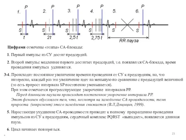 * Цифрами отмечены «этапы» СА-блокады: 1. Первый импульс из СУ достиг