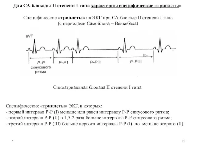 * Для СА-блокады II степени I типа характерны специфические «триплеты». Специфические