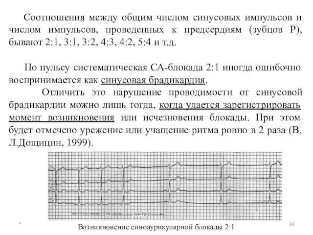 * Соотношения между общим числом синусовых импульсов и числом импульсов, проведенных