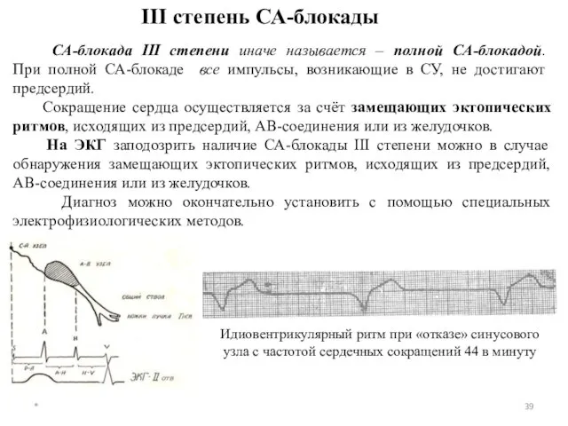 СА-блокада III степени иначе называется – полной СА-блокадой. При полной СА-блокаде