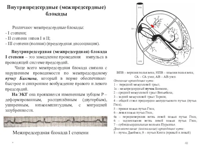 Внутрипредсердные (межпредсердные) блокады Различают межпредсердные блокады: - I степени; - II