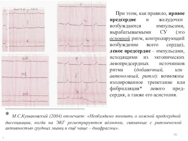 * При этом, как правило, правое предсердие и желудочки возбуждаются импульсами,