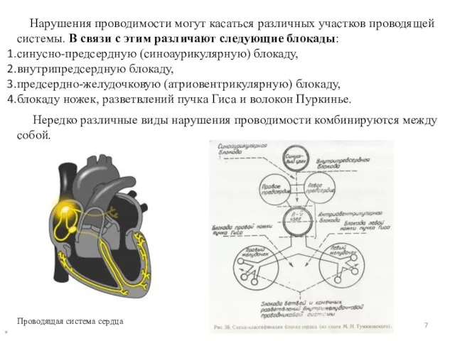 Нарушения проводимости могут касаться различных участков проводящей системы. В связи с