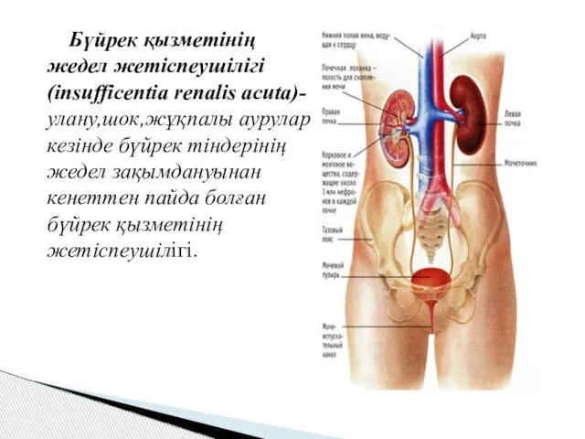 Бүйрек қызметінің жедел жетіспеушілігі (insufficentia renalis acuta)-улану,шок,жұқпалы аурулар кезінде бүйрек тіндерінің