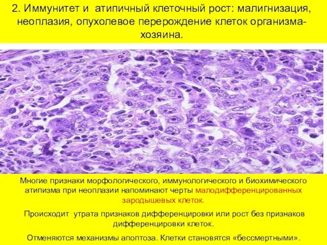 2. Иммунитет и атипичный клеточный рост: малигнизация, неоплазия, опухолевое перерождение клеток