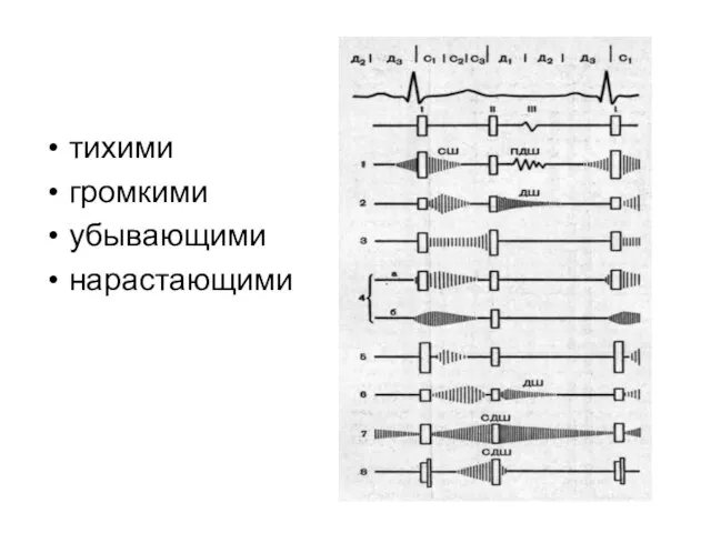 тихими громкими убывающими нарастающими
